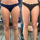 RainRee™ - Anti-Cellulite Massager